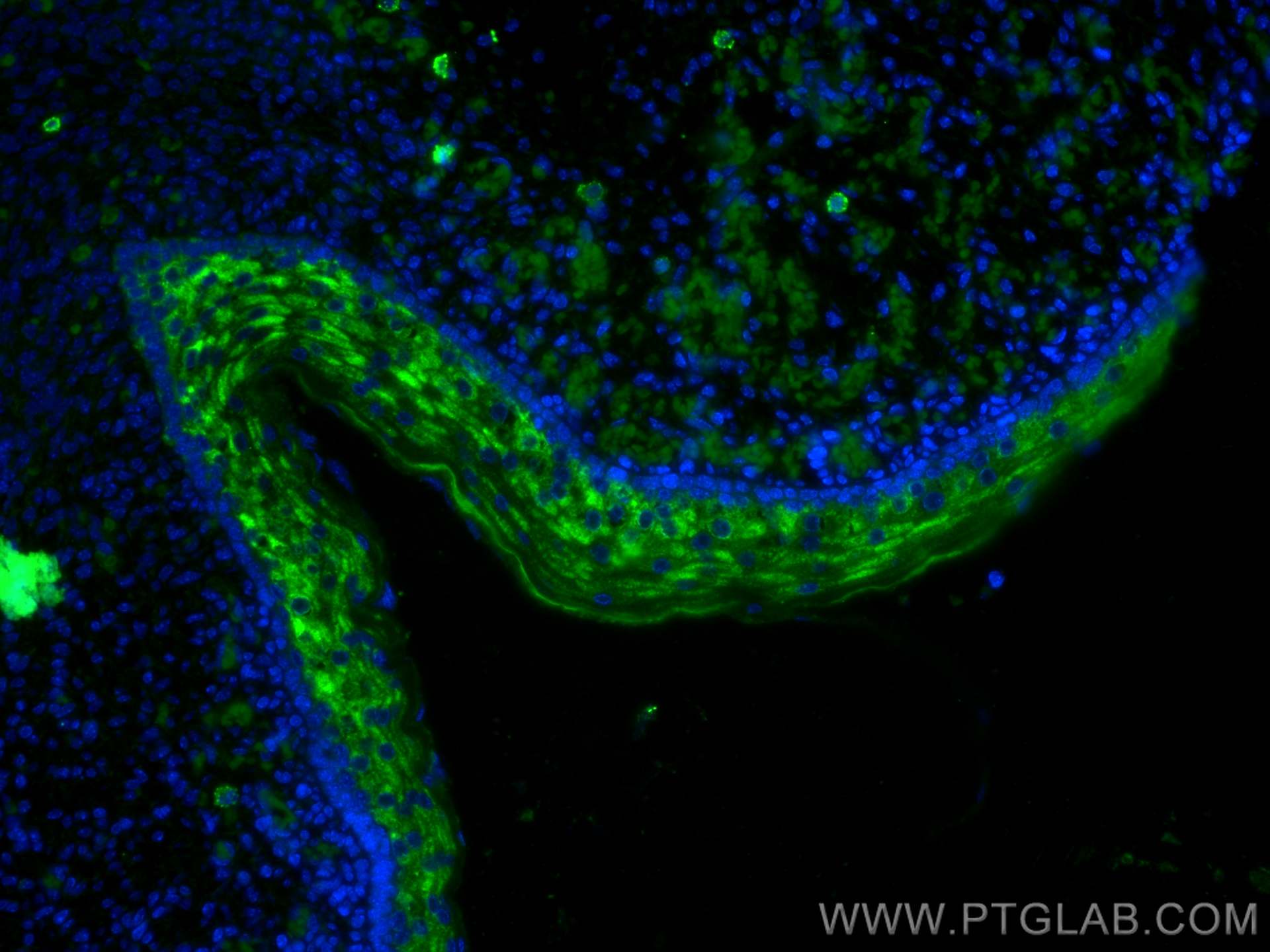 Immunofluorescence (IF) / fluorescent staining of mouse embryo tissue using TRIM32 Polyclonal antibody (10326-1-AP)