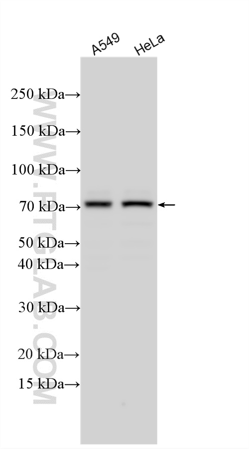 Western Blot (WB) analysis of various lysates using TRIM32 Polyclonal antibody (10326-1-AP)