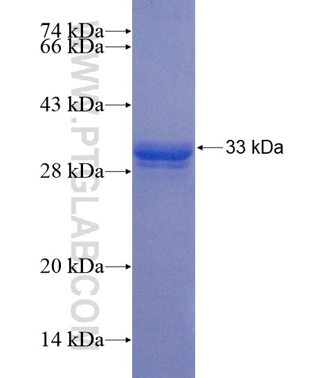 TRIM4 fusion protein Ag22112 SDS-PAGE