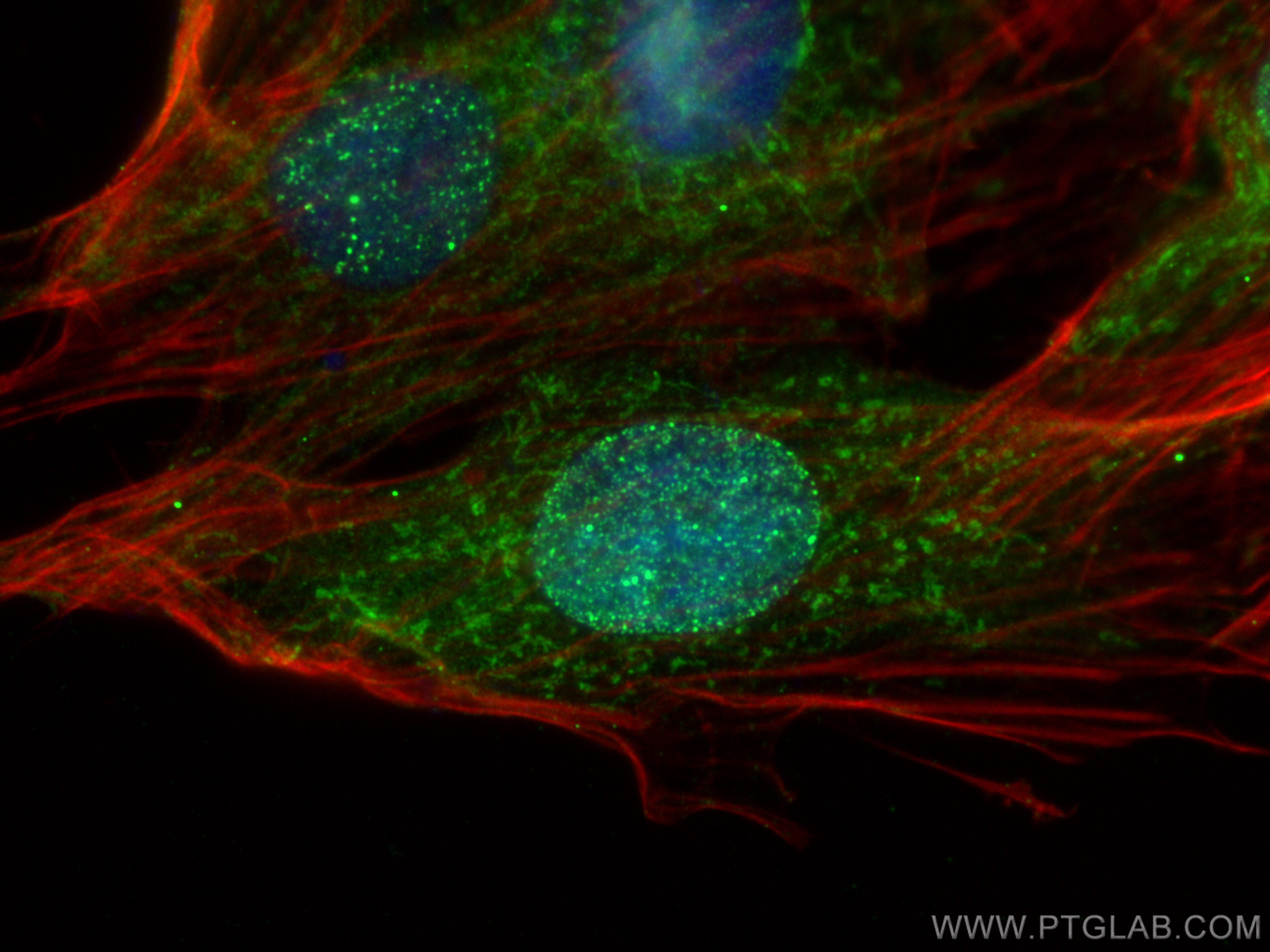 Immunofluorescence (IF) / fluorescent staining of H9C2 cells using TRIM41 Polyclonal antibody (18468-1-AP)