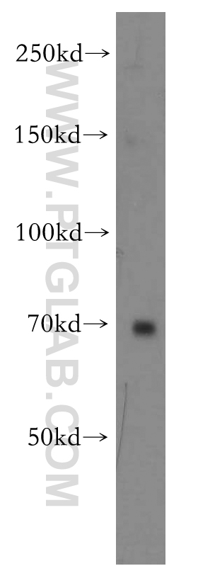 Western Blot (WB) analysis of human placenta tissue using TRIM41 Polyclonal antibody (18468-1-AP)