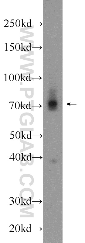 Western Blot (WB) analysis of mouse liver tissue using TRIM41 Polyclonal antibody (18468-1-AP)