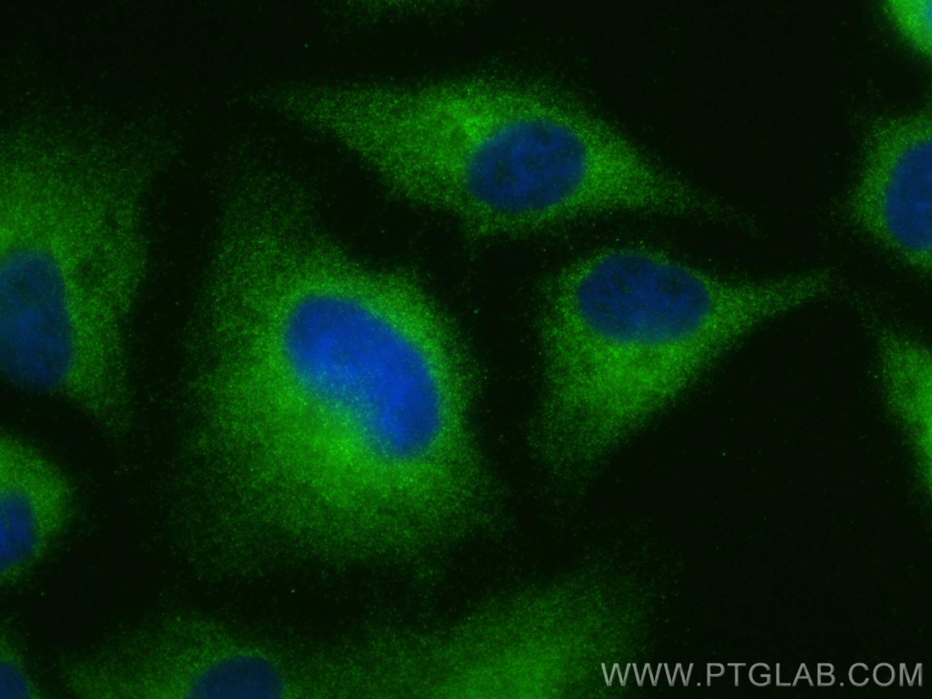 Immunofluorescence (IF) / fluorescent staining of A549 cells using TRIM46 Polyclonal antibody (21026-1-AP)