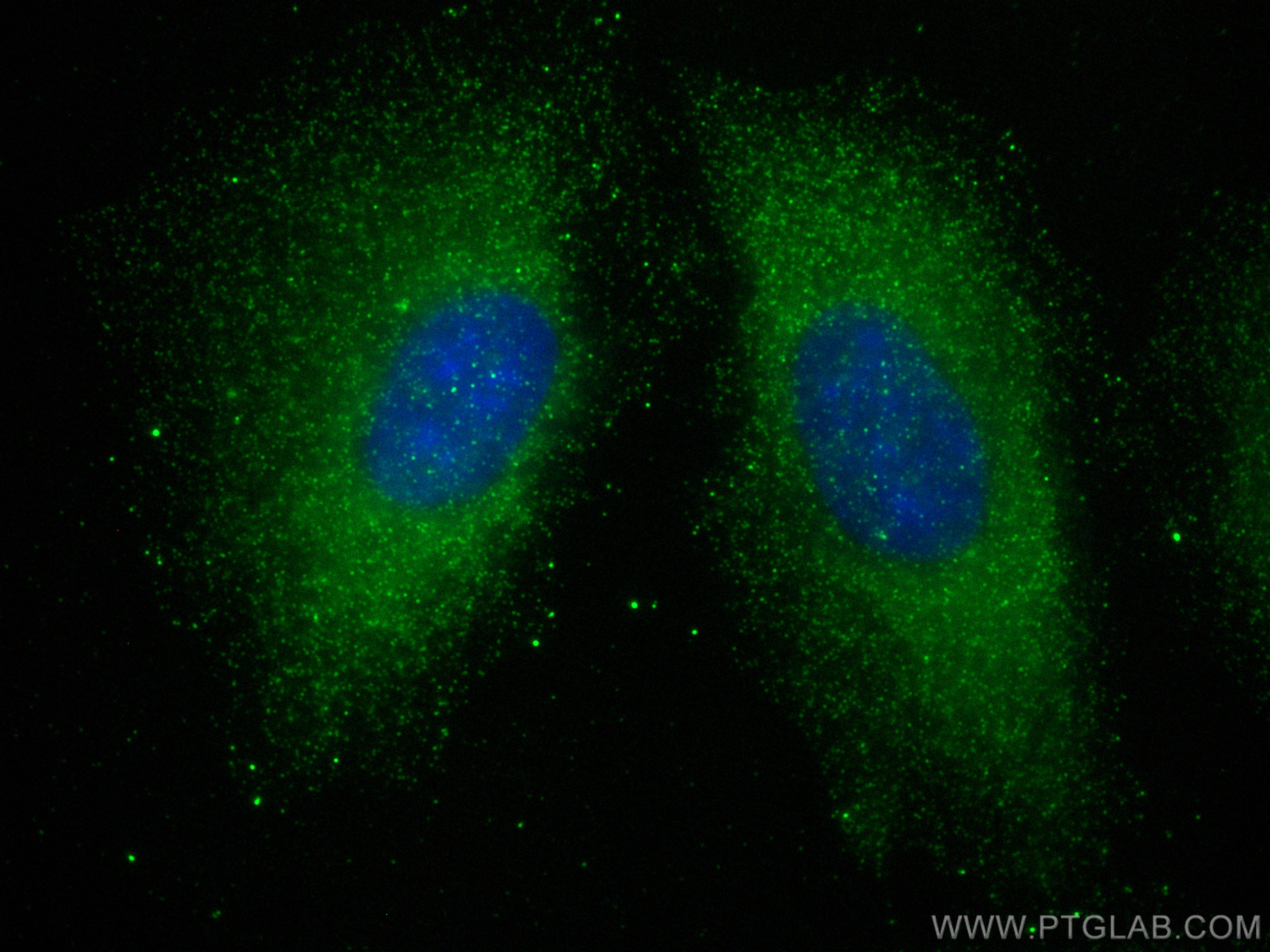 Immunofluorescence (IF) / fluorescent staining of A549 cells using TRIM46 Recombinant antibody (83614-2-RR)