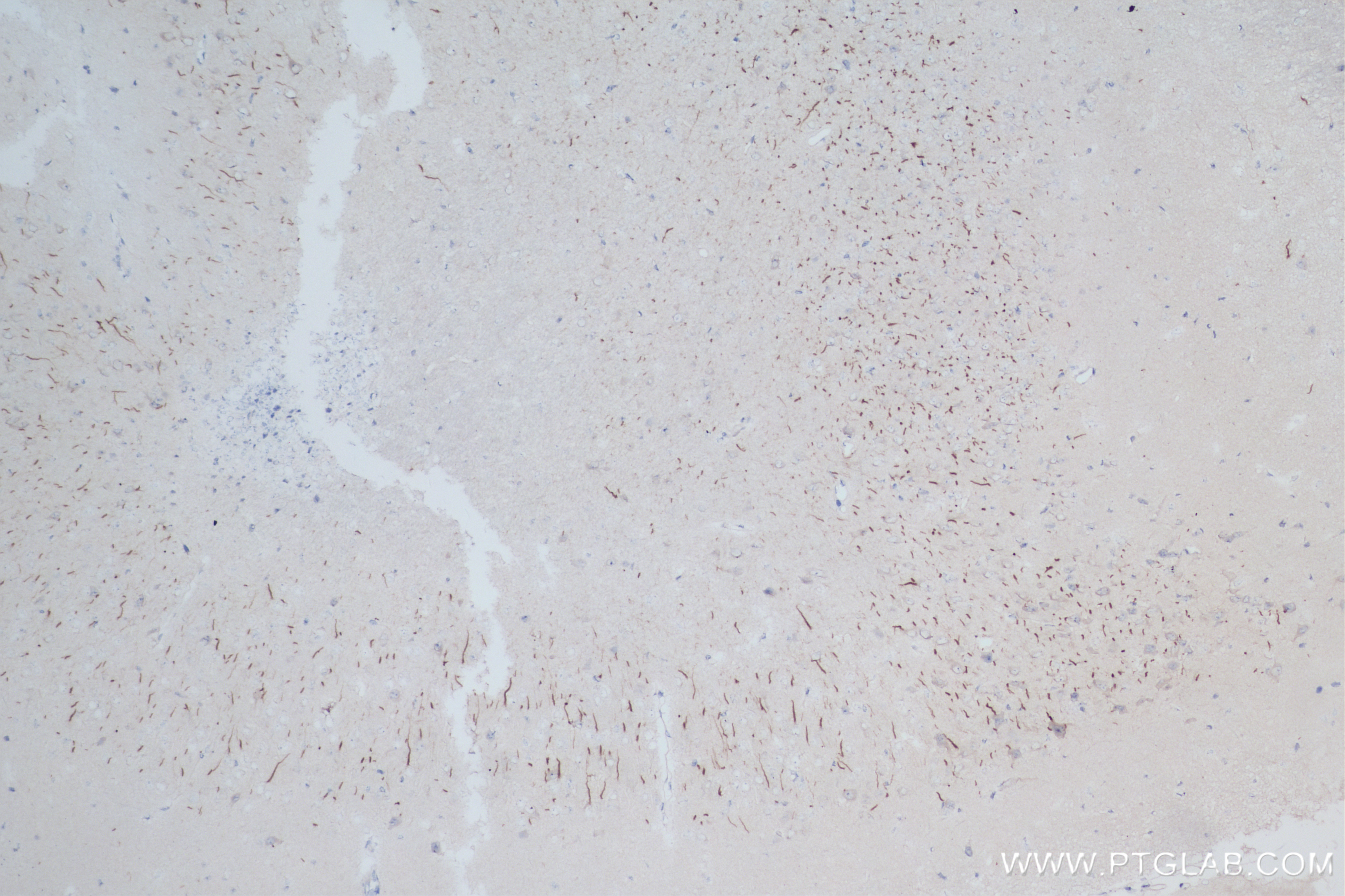 Immunohistochemistry (IHC) staining of mouse brain tissue using TRIM46 Recombinant antibody (83614-2-RR)