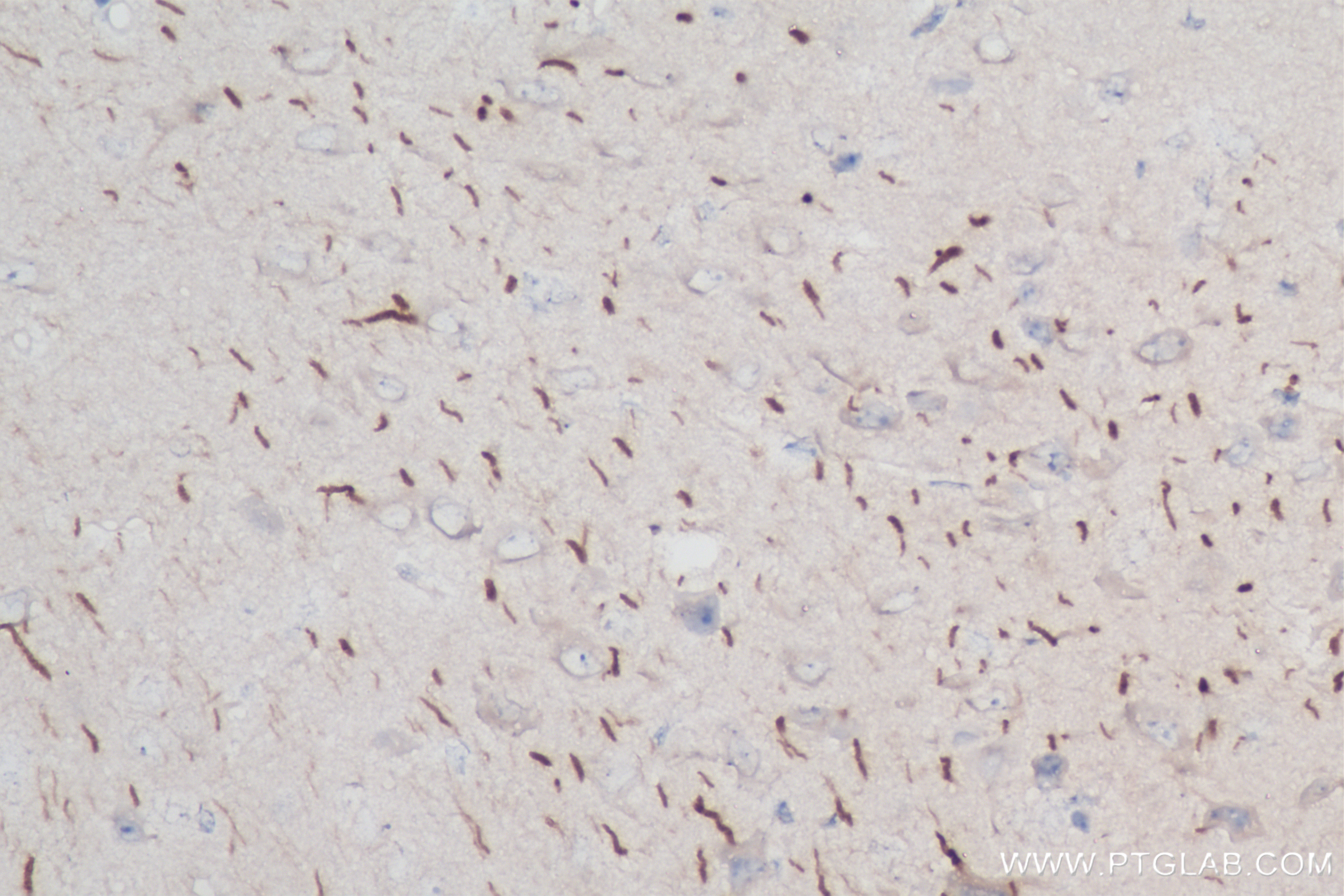 Immunohistochemistry (IHC) staining of mouse brain tissue using TRIM46 Recombinant antibody (83614-2-RR)