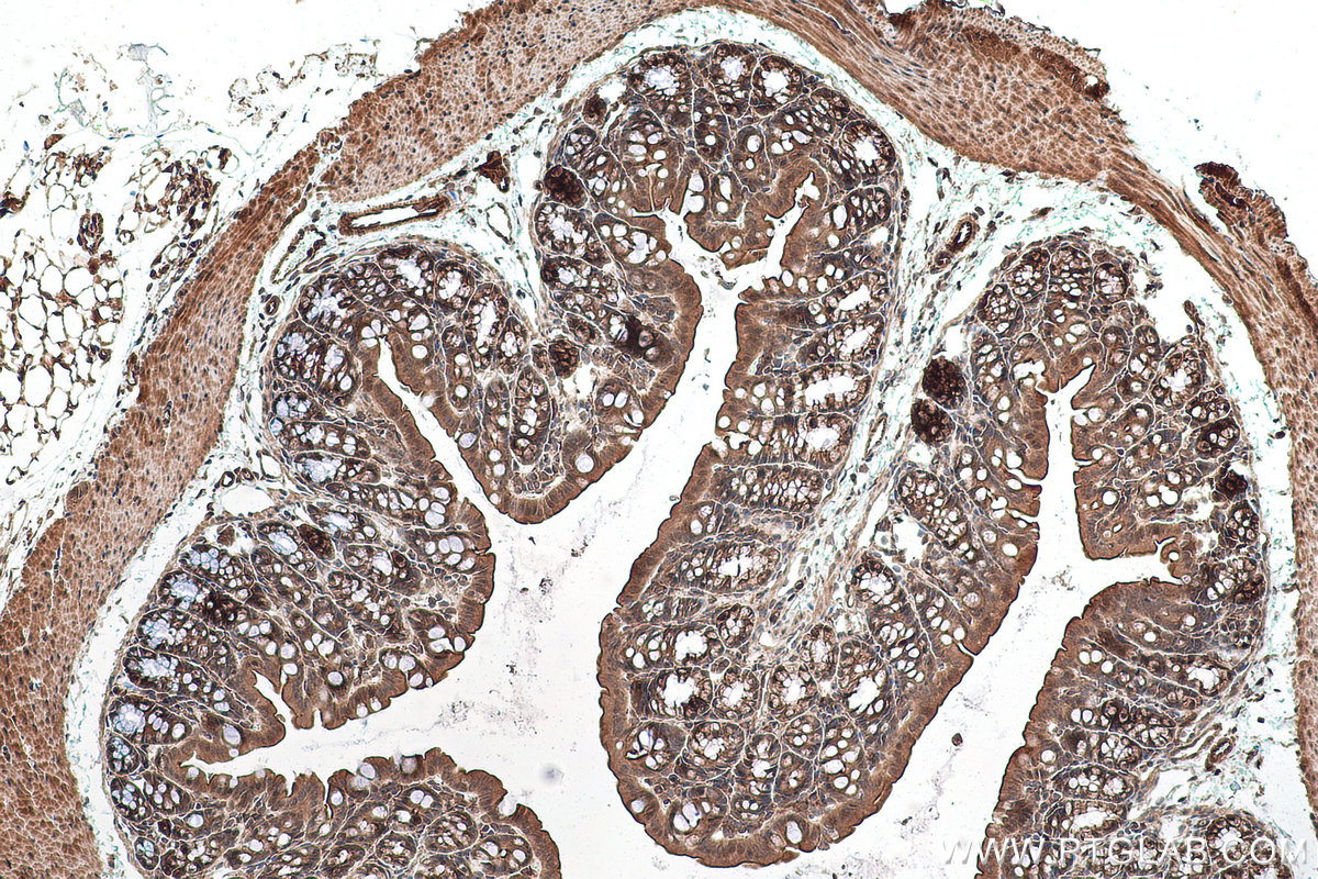 Immunohistochemistry (IHC) staining of mouse colon tissue using TRIM47 Polyclonal antibody (26885-1-AP)