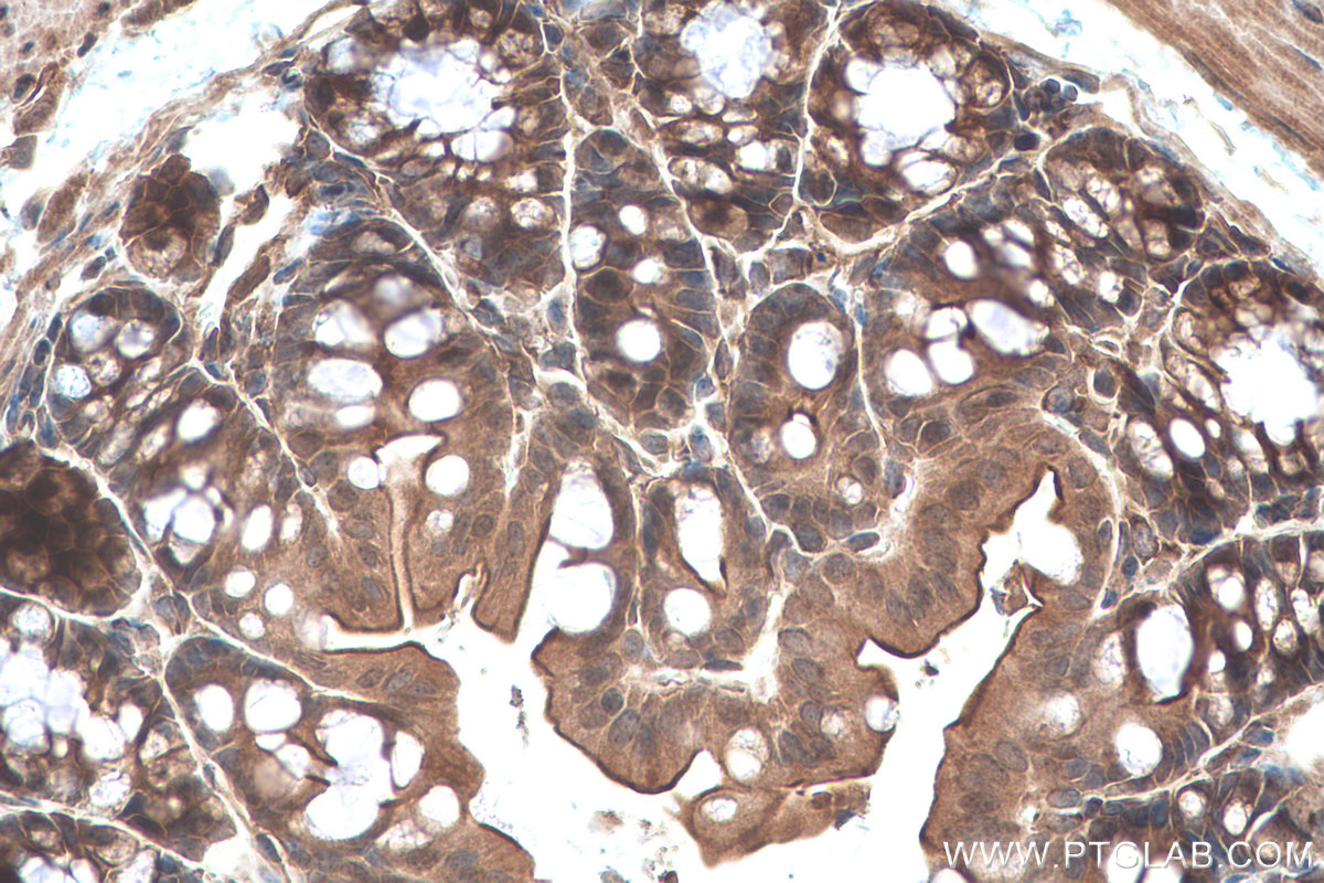 Immunohistochemistry (IHC) staining of mouse colon tissue using TRIM47 Polyclonal antibody (26885-1-AP)