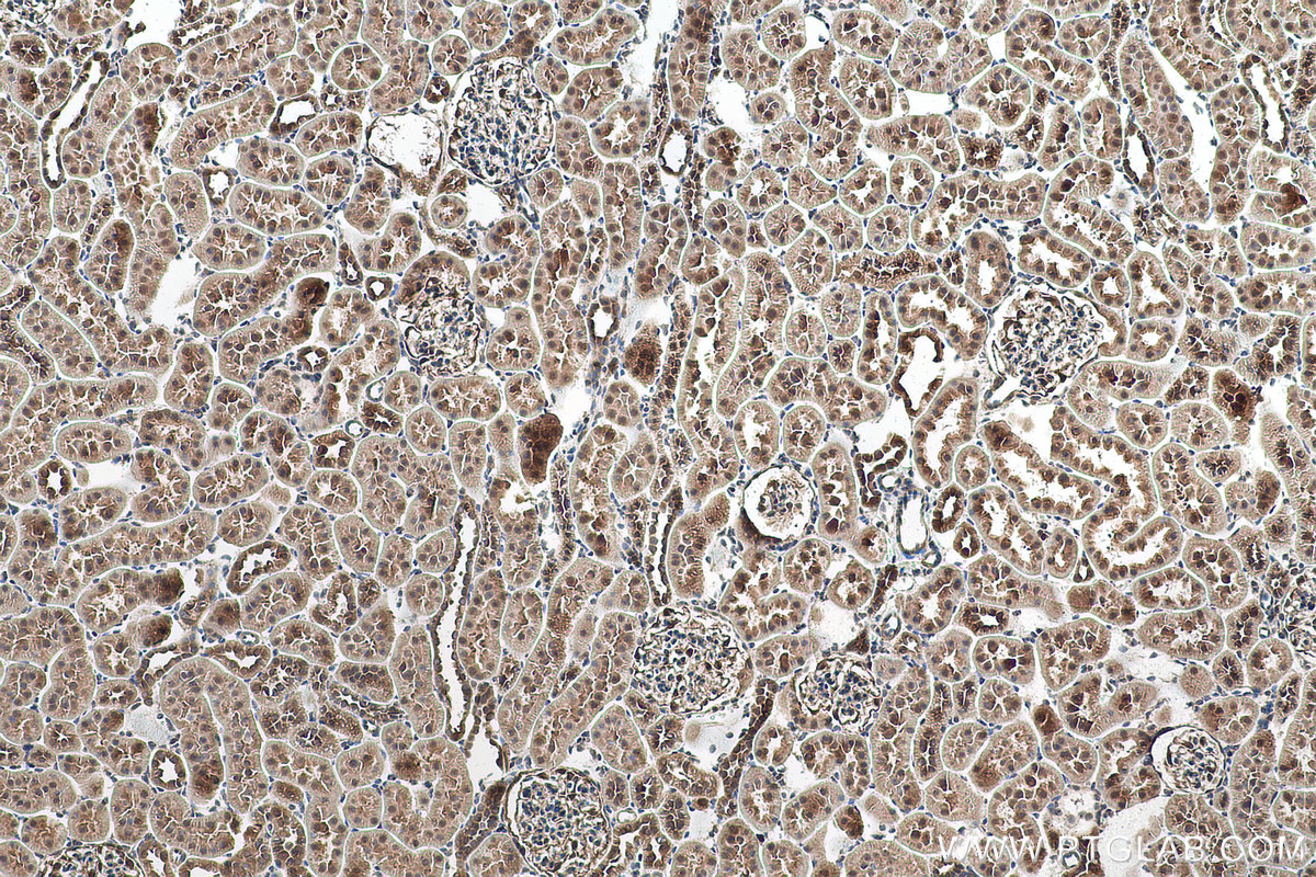 Immunohistochemistry (IHC) staining of rat kidney tissue using TRIM47 Polyclonal antibody (26885-1-AP)