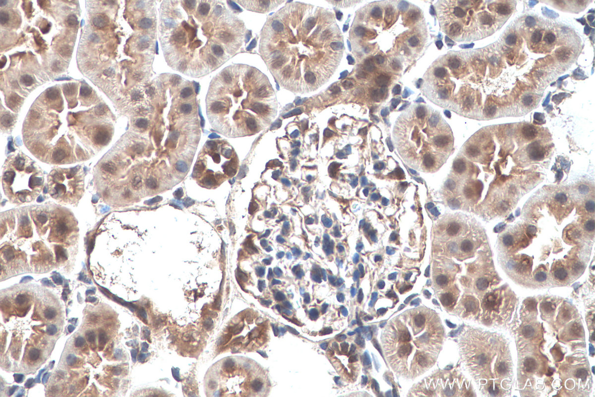 Immunohistochemistry (IHC) staining of rat kidney tissue using TRIM47 Polyclonal antibody (26885-1-AP)