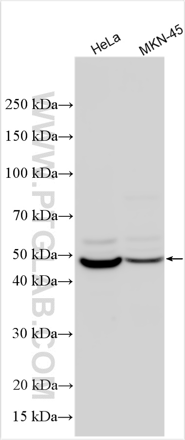 Western Blot (WB) analysis of various lysates using TRIM5 Polyclonal antibody (11476-1-AP)