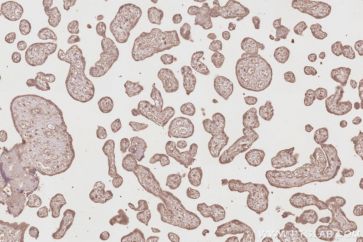 Immunohistochemistry (IHC) staining of human placenta tissue using TRIM5 Monoclonal antibody (67492-1-Ig)