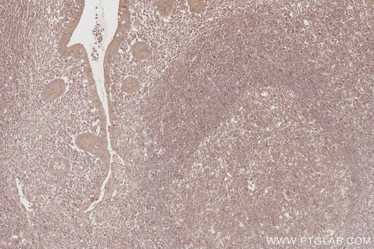 Immunohistochemistry (IHC) staining of human appendicitis tissue using TRIM5 Monoclonal antibody (67492-1-Ig)