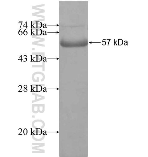 TRIM52 fusion protein Ag15064 SDS-PAGE