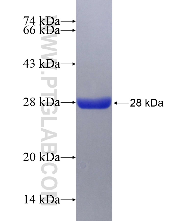 TRIM59 fusion protein Ag29572 SDS-PAGE