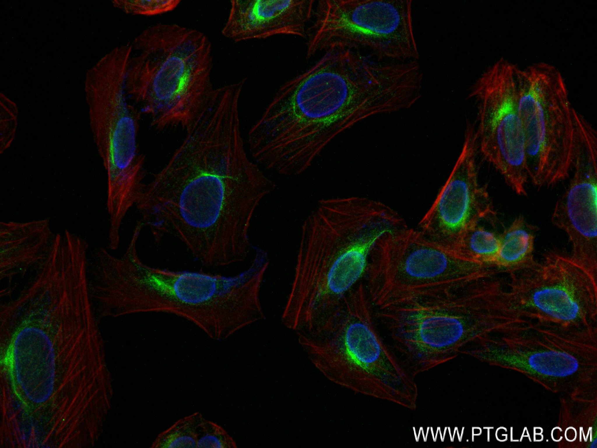 Immunofluorescence (IF) / fluorescent staining of U2OS cells using TRIM62 Recombinant antibody (82892-1-RR)