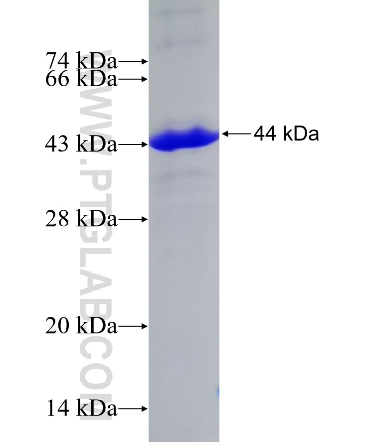 TRIM62 fusion protein Ag7412 SDS-PAGE