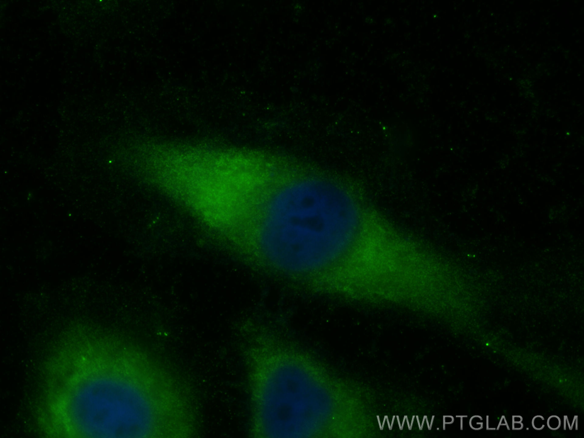 Immunofluorescence (IF) / fluorescent staining of HeLa cells using TRIM63 Polyclonal antibody (55456-1-AP)