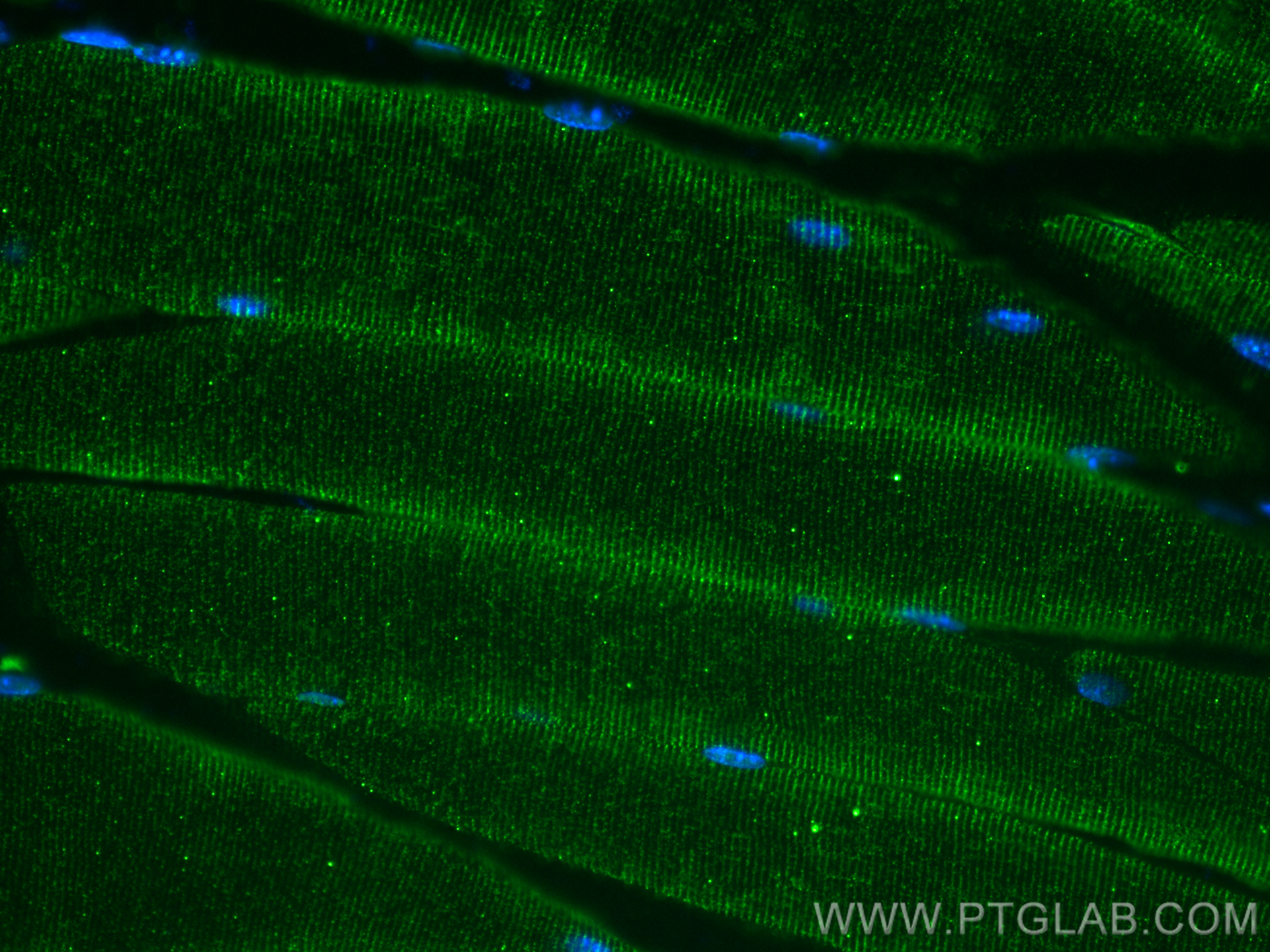 Immunofluorescence (IF) / fluorescent staining of mouse skeletal muscle tissue using TRIM72 Monoclonal antibody (67403-1-Ig)