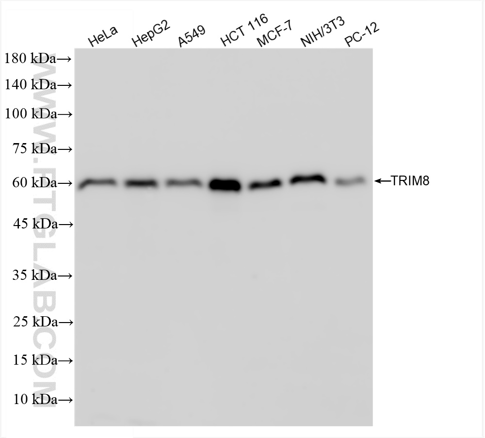 Western Blot (WB) analysis of various lysates using TRIM8 Recombinant antibody (85169-1-RR)