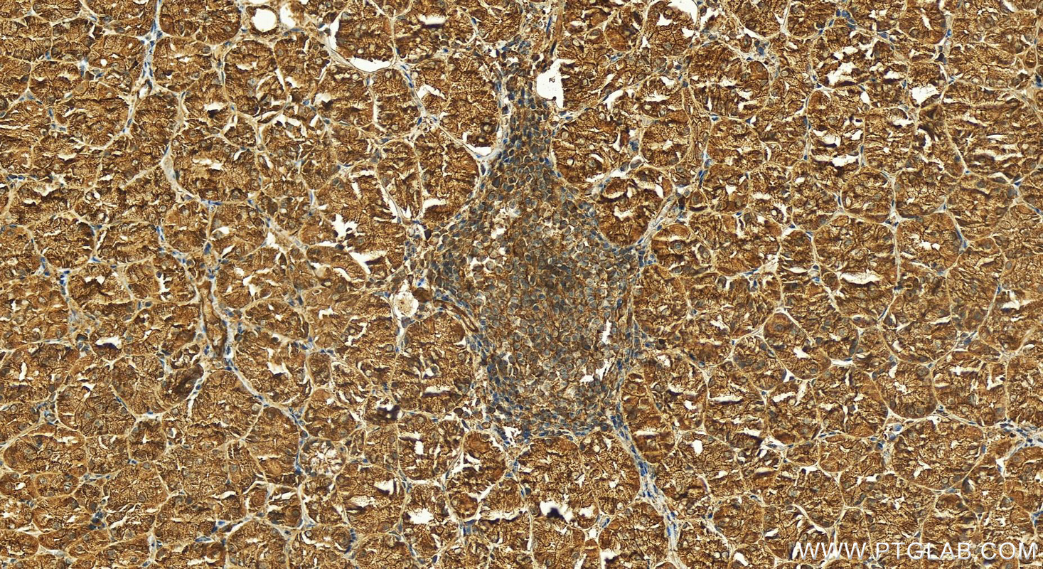 Immunohistochemistry (IHC) staining of human stomach tissue using TRIOBP Polyclonal antibody (16124-1-AP)