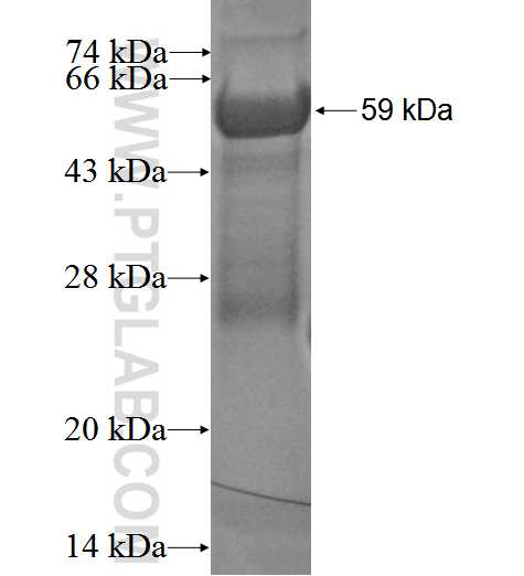 TRIP4 fusion protein Ag2987 SDS-PAGE