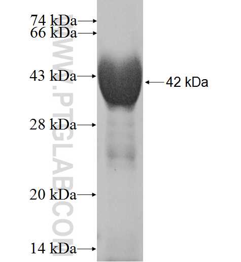 TRMT12 fusion protein Ag9258 SDS-PAGE