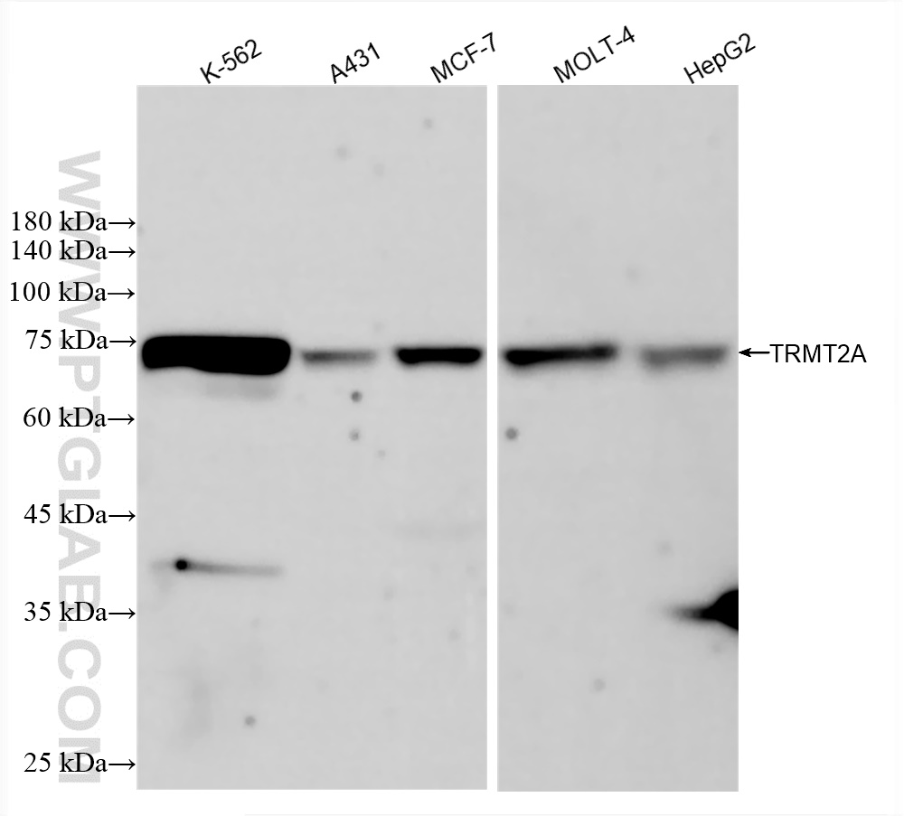 Western Blot (WB) analysis of various lysates using TRMT2A Recombinant antibody (83463-8-RR)