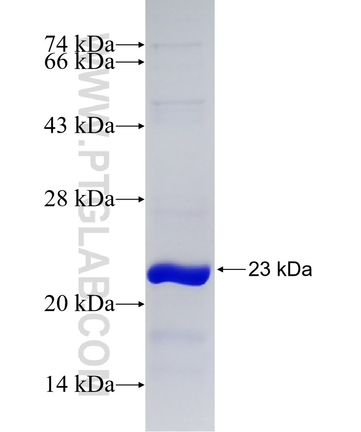 TRMT2B fusion protein Ag14969 SDS-PAGE