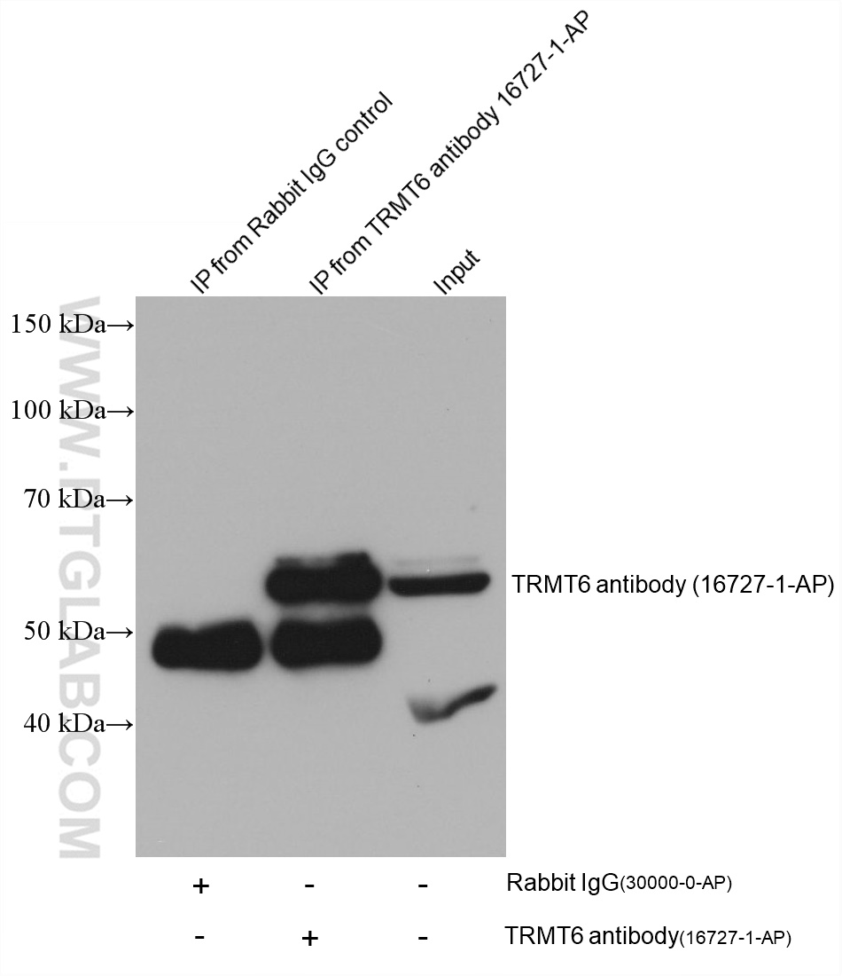Immunoprecipitation (IP) experiment of HeLa cells using TRMT6 Polyclonal antibody (16727-1-AP)