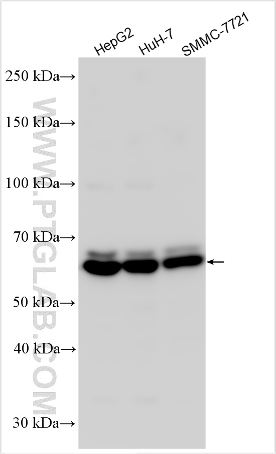 Western Blot (WB) analysis of various lysates using TRMT6 Polyclonal antibody (16727-1-AP)