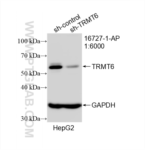 Western Blot (WB) analysis of HepG2 cells using TRMT6 Polyclonal antibody (16727-1-AP)