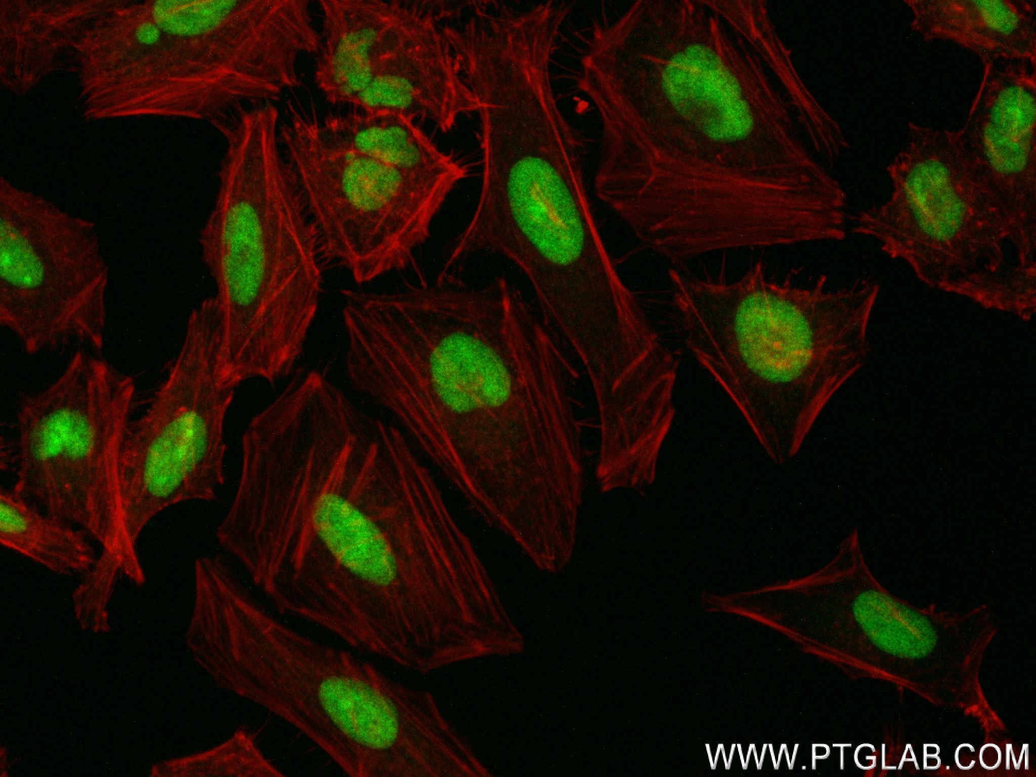 Immunofluorescence (IF) / fluorescent staining of HeLa cells using TRMT6 Recombinant antibody (83843-5-RR)