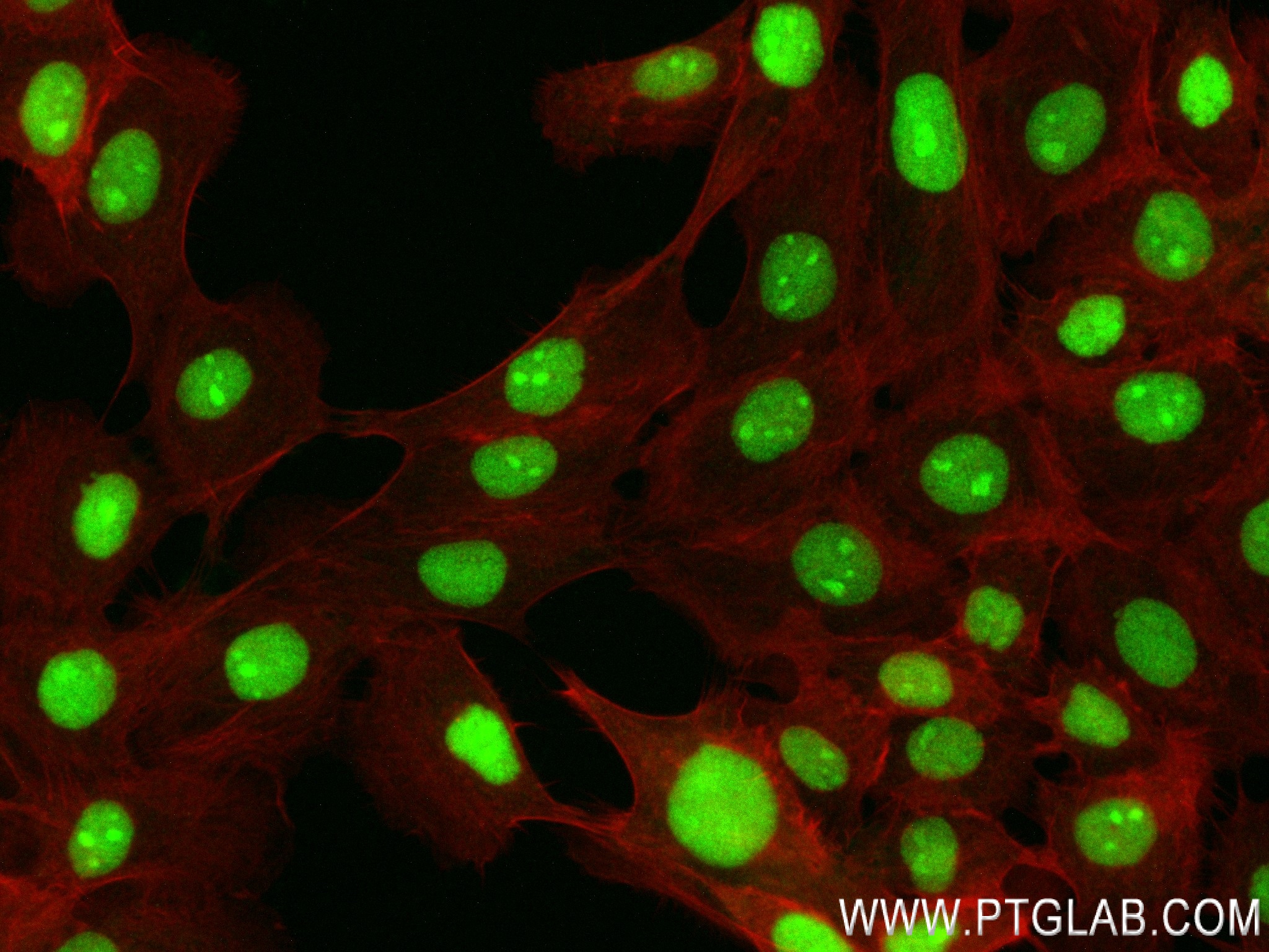 Immunofluorescence (IF) / fluorescent staining of A431 cells using TRMT6 Recombinant antibody (83843-5-RR)