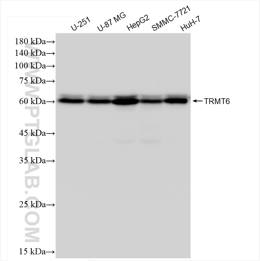 Western Blot (WB) analysis of various lysates using TRMT6 Recombinant antibody (83843-5-RR)