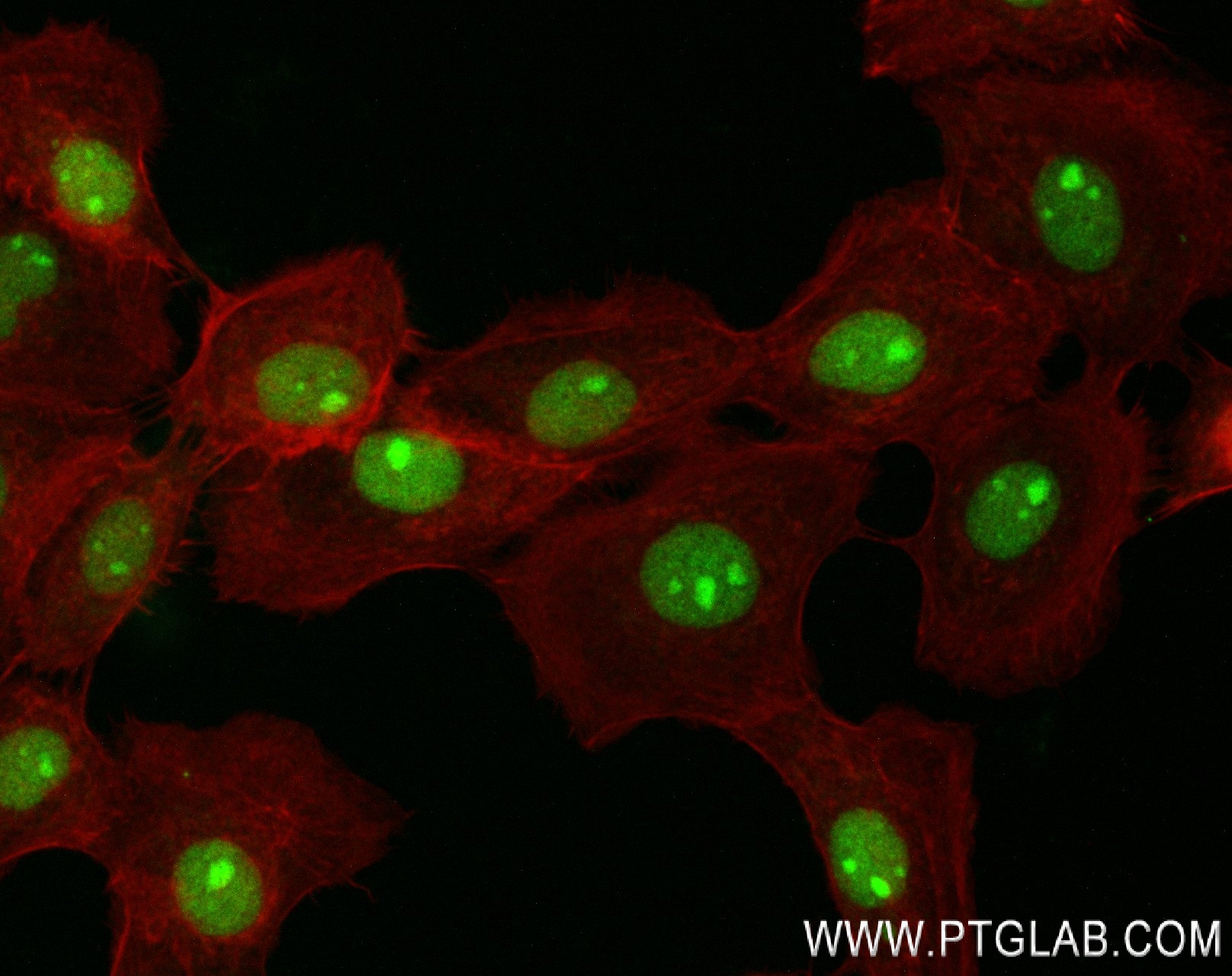 Immunofluorescence (IF) / fluorescent staining of A431 cells using TRMT6 Recombinant antibody (83843-6-RR)