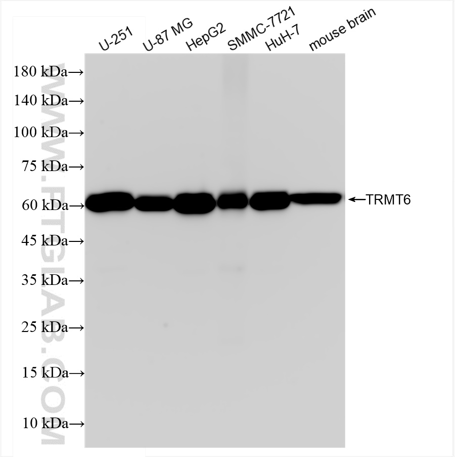 Western Blot (WB) analysis of various lysates using TRMT6 Recombinant antibody (83843-6-RR)