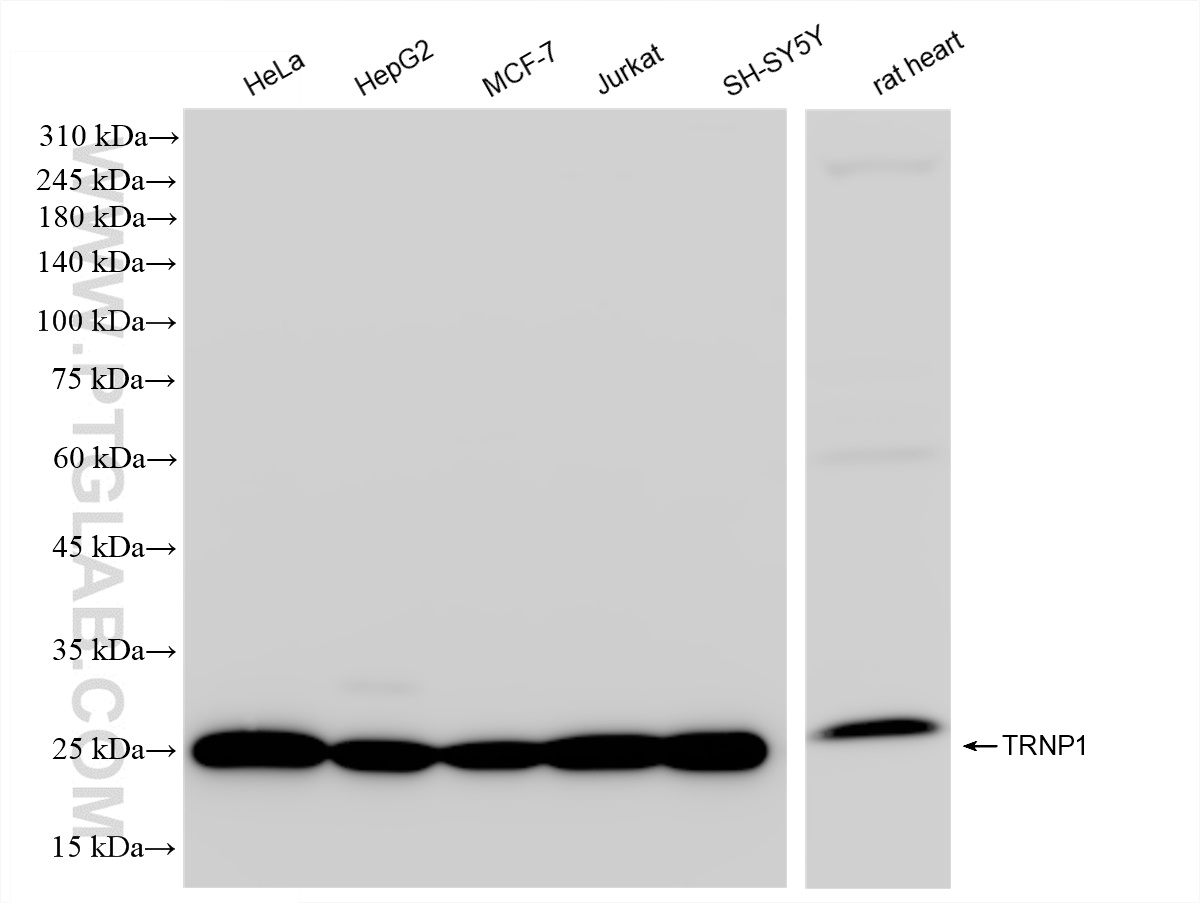 Western Blot (WB) analysis of various lysates using TRNP1 Recombinant antibody (83410-3-RR)