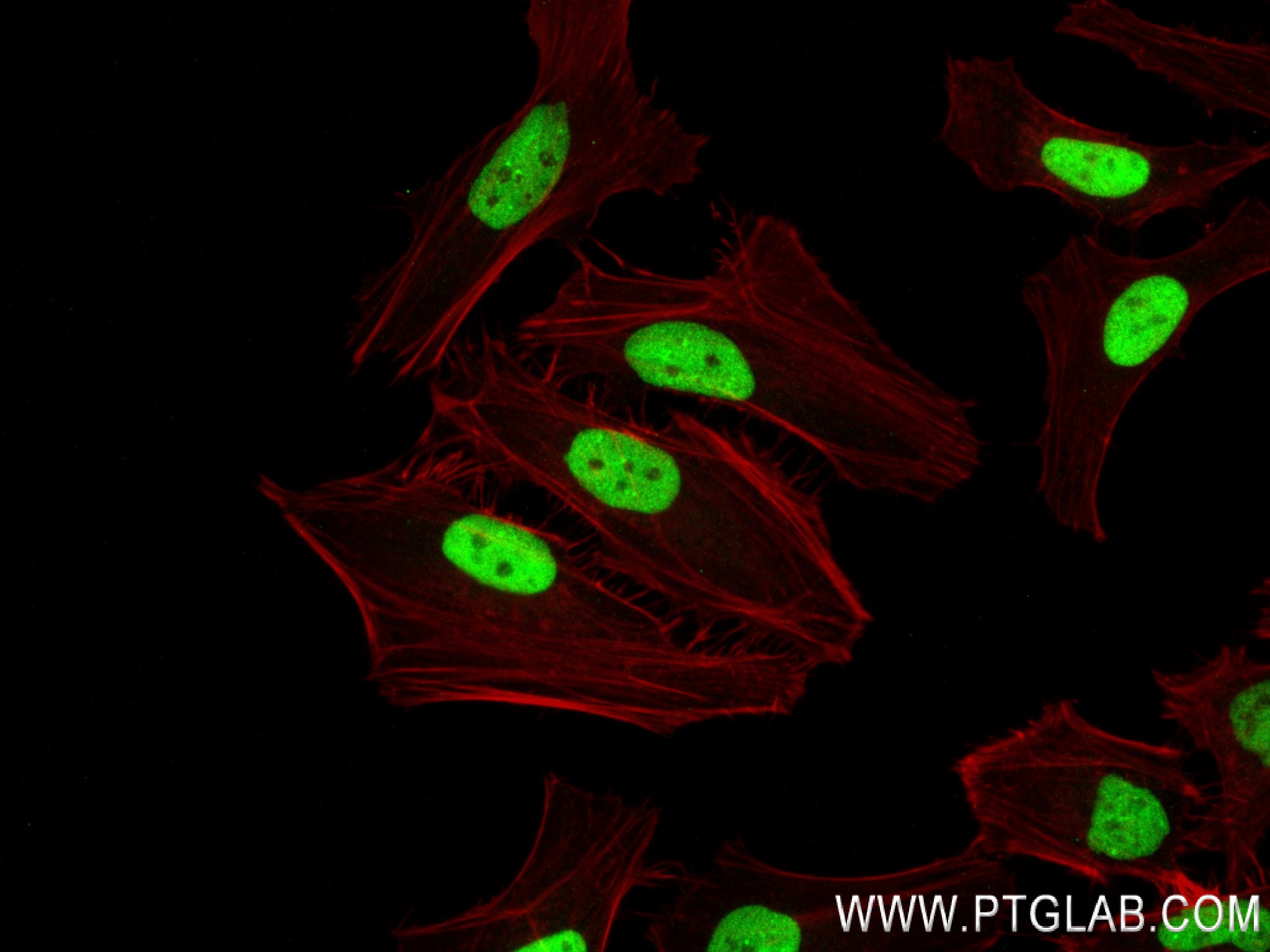 Immunofluorescence (IF) / fluorescent staining of HeLa cells using TRNP1 Recombinant antibody (83410-4-RR)