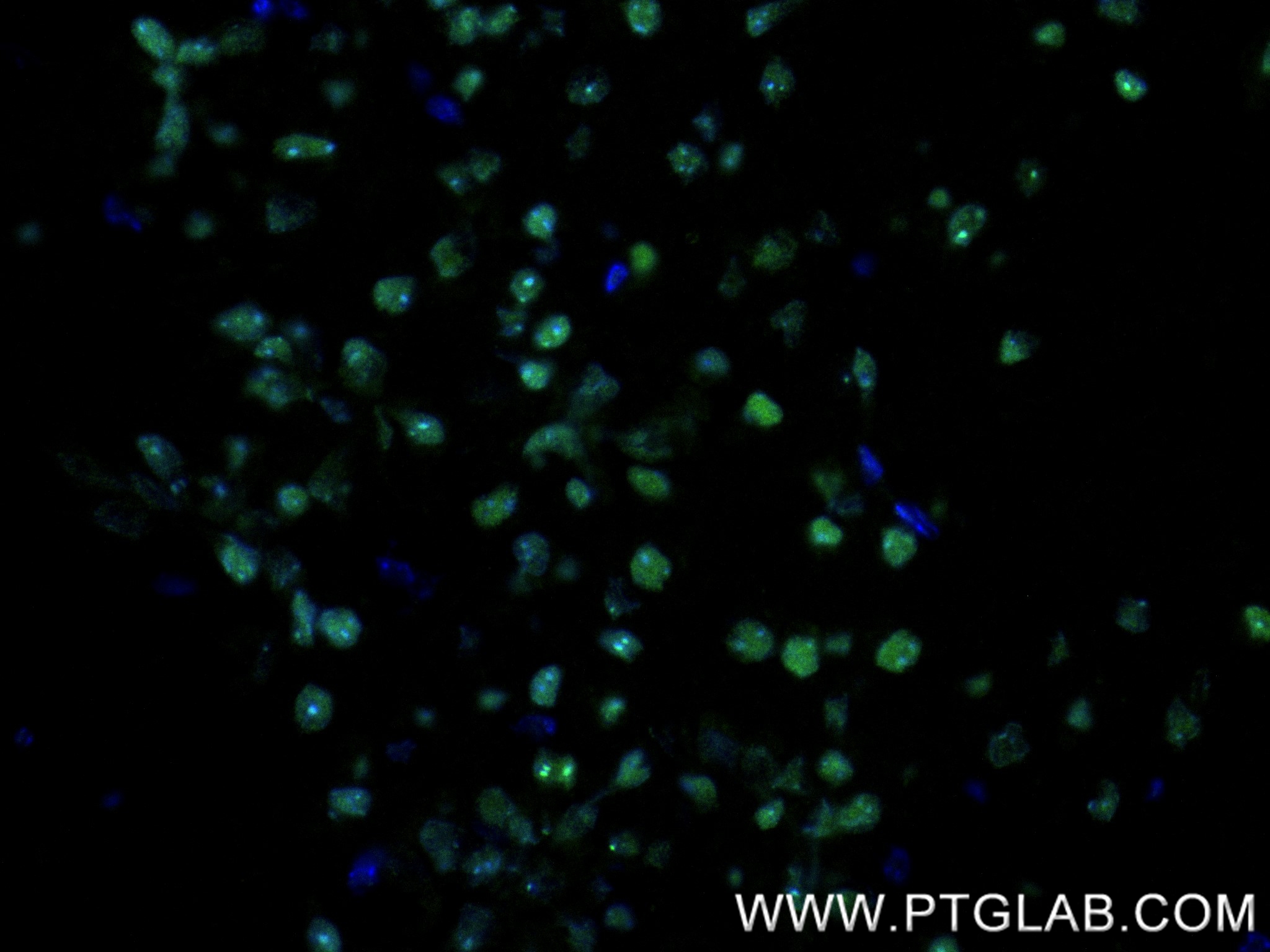 Immunofluorescence (IF) / fluorescent staining of mouse brain tissue using TRNP1 Recombinant antibody (83410-4-RR)