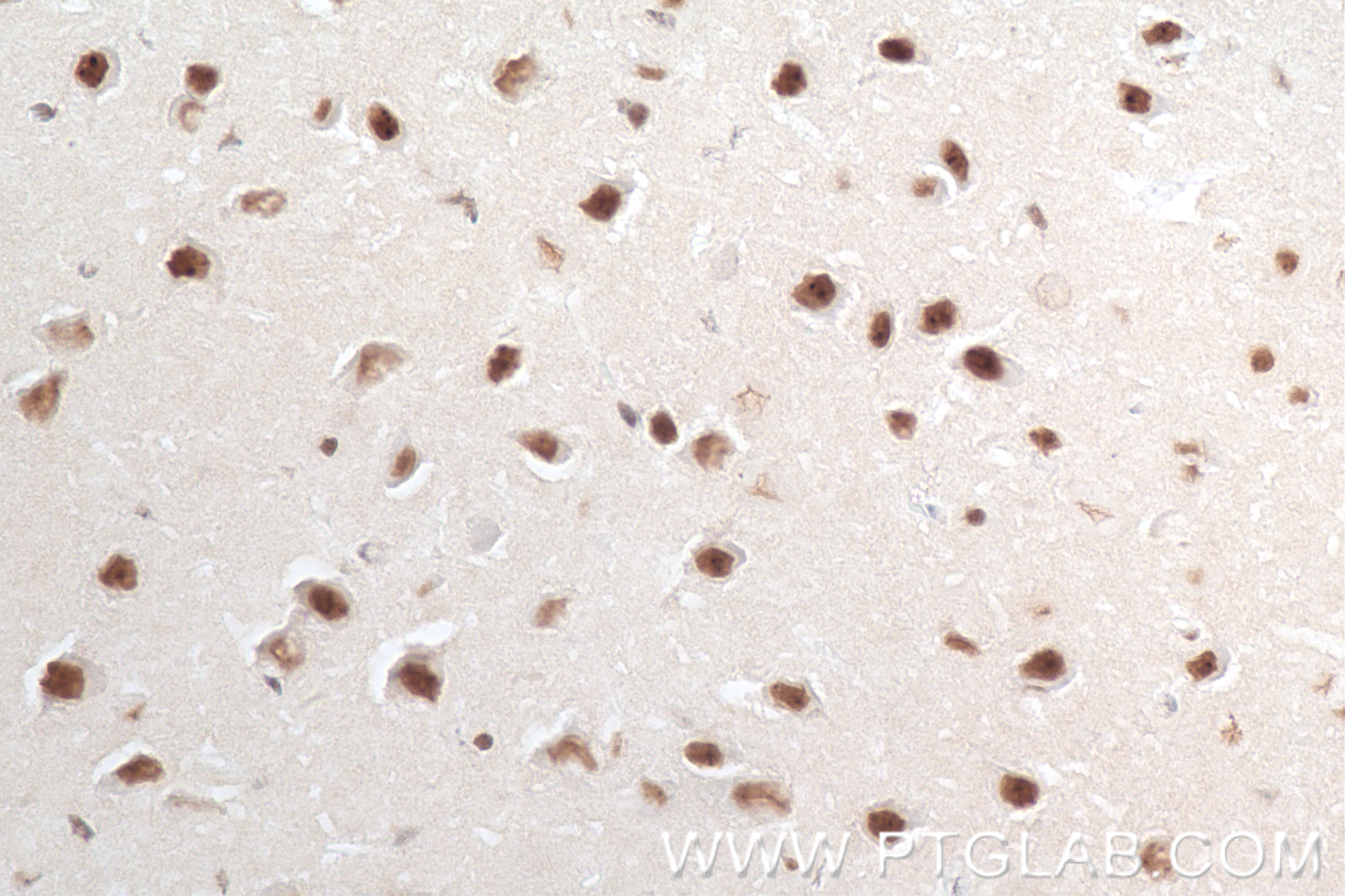 Immunohistochemistry (IHC) staining of mouse brain tissue using TRNP1 Recombinant antibody (83410-4-RR)