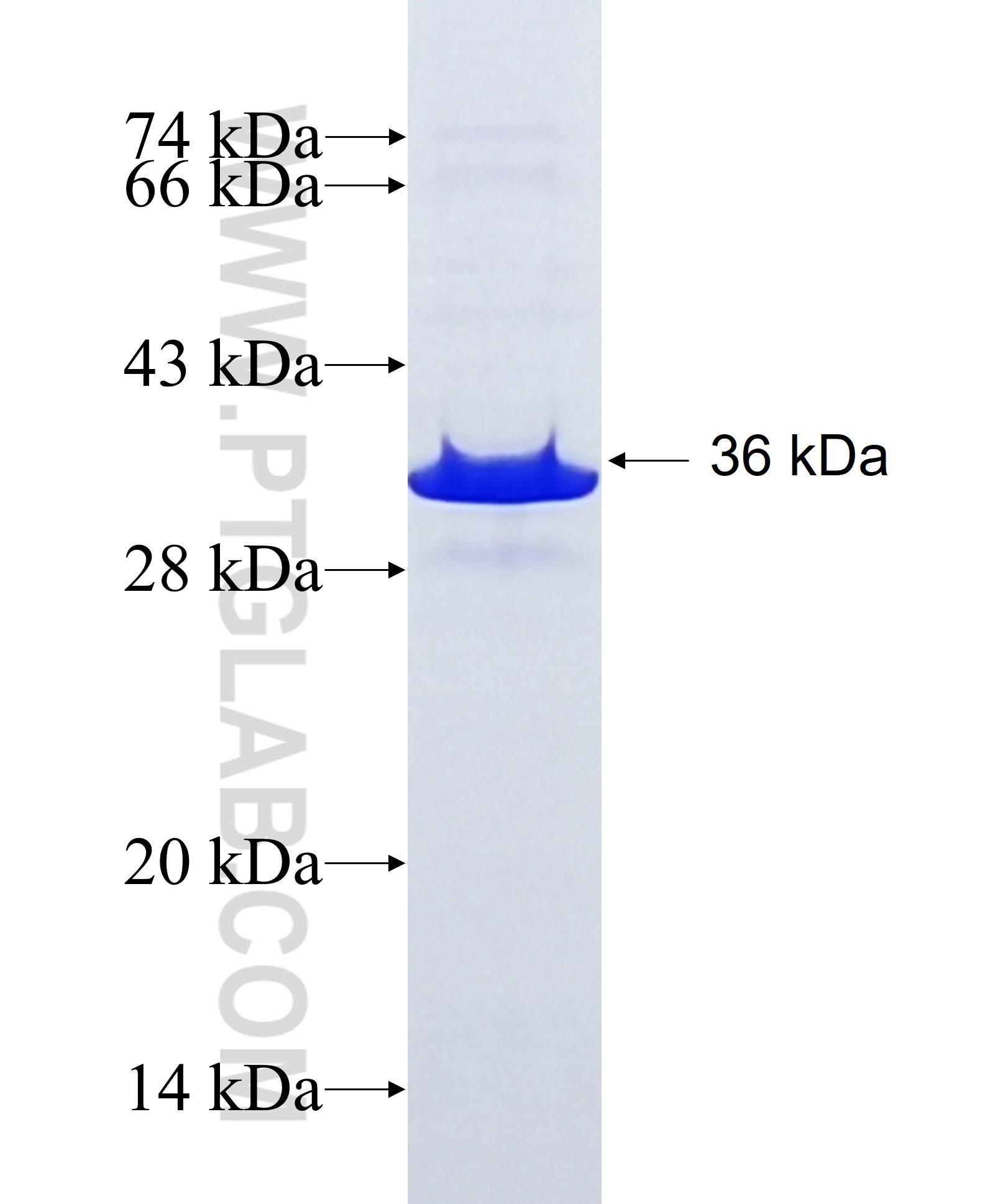 TRNP1 fusion protein Ag22876 SDS-PAGE