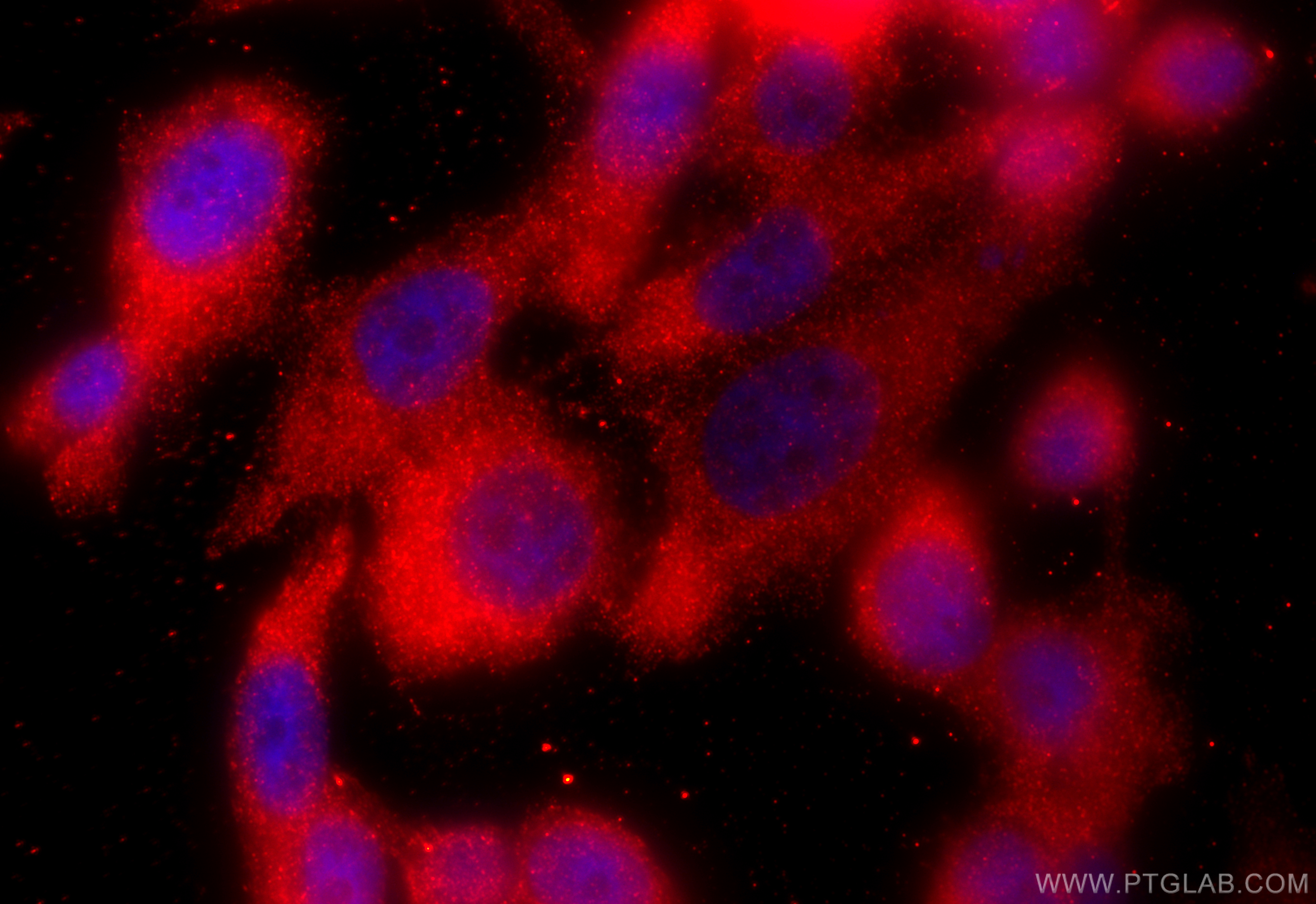 Immunofluorescence (IF) / fluorescent staining of PC-3 cells using TROVE2 Polyclonal antibody (12718-1-AP)