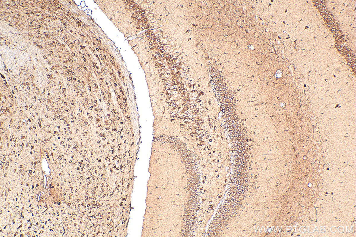 Immunohistochemistry (IHC) staining of mouse brain tissue using TRPA1 Polyclonal antibody (19124-1-AP)