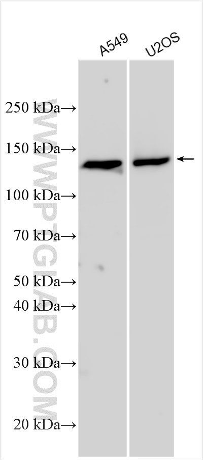 Western Blot (WB) analysis of various lysates using TRPA1 Polyclonal antibody (25226-1-AP)