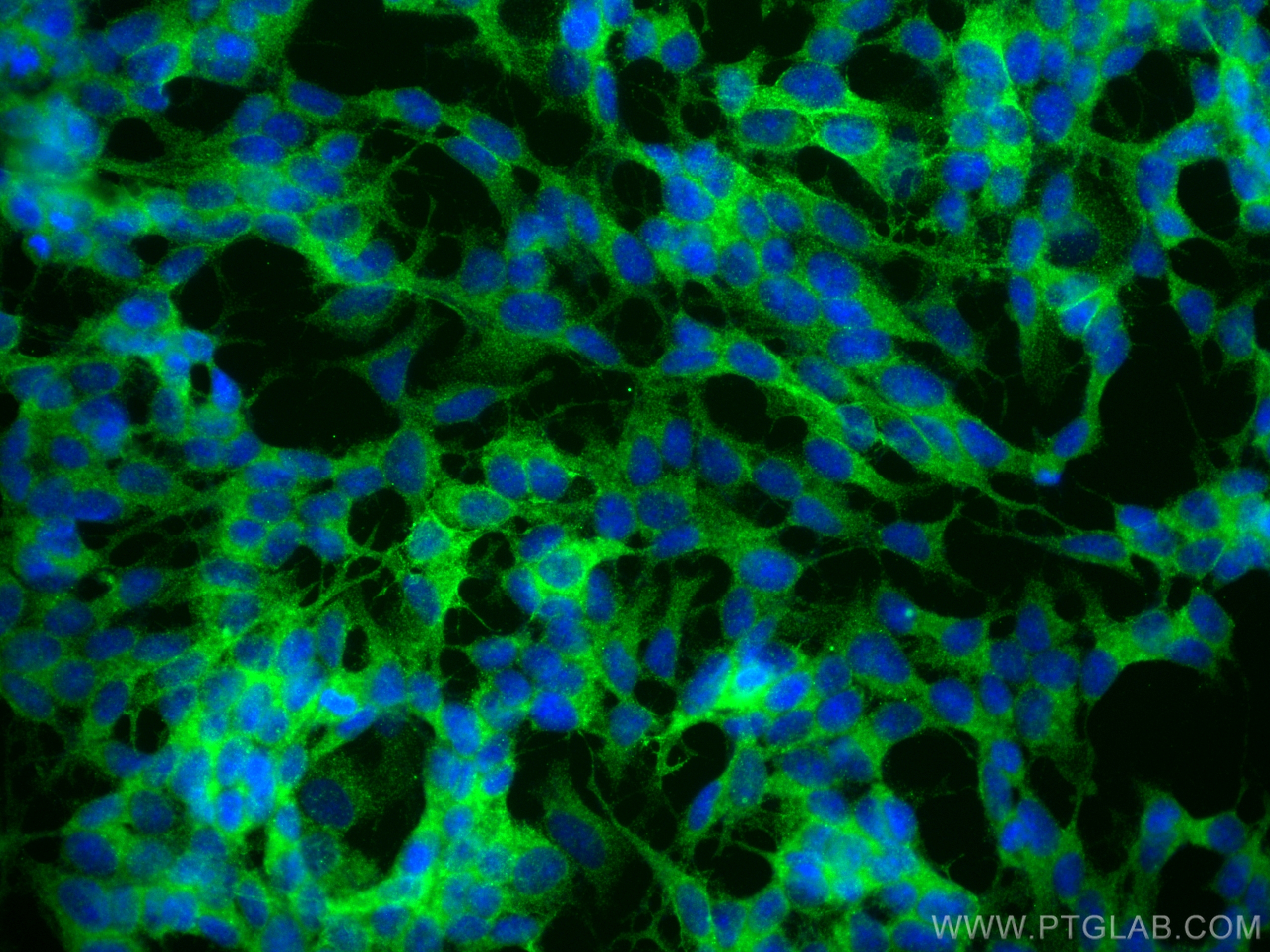 Immunofluorescence (IF) / fluorescent staining of SH-SY5Y cells using TRPC5 Polyclonal antibody (25890-1-AP)