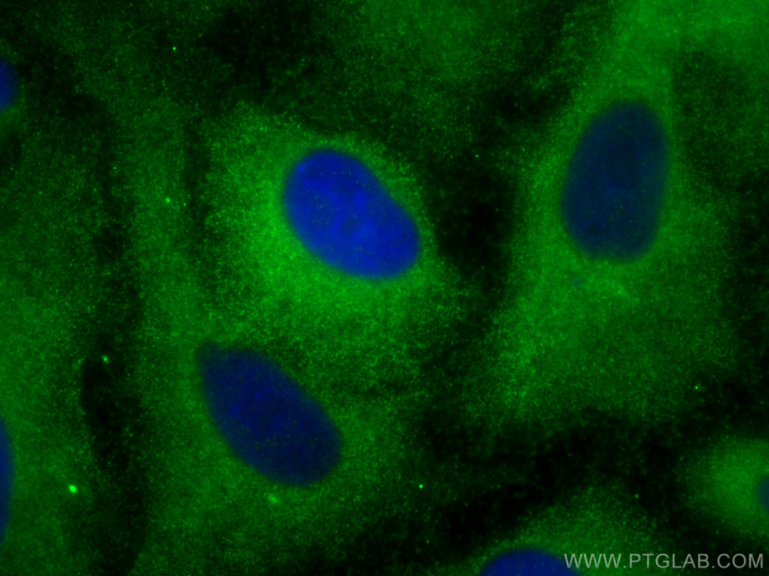 Immunofluorescence (IF) / fluorescent staining of A549 cells using TRPC6 Polyclonal antibody (18236-1-AP)