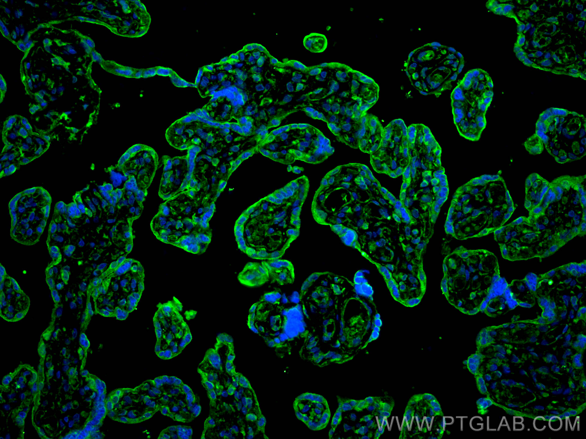 Immunofluorescence (IF) / fluorescent staining of human placenta tissue using TRPC6 Polyclonal antibody (18236-1-AP)