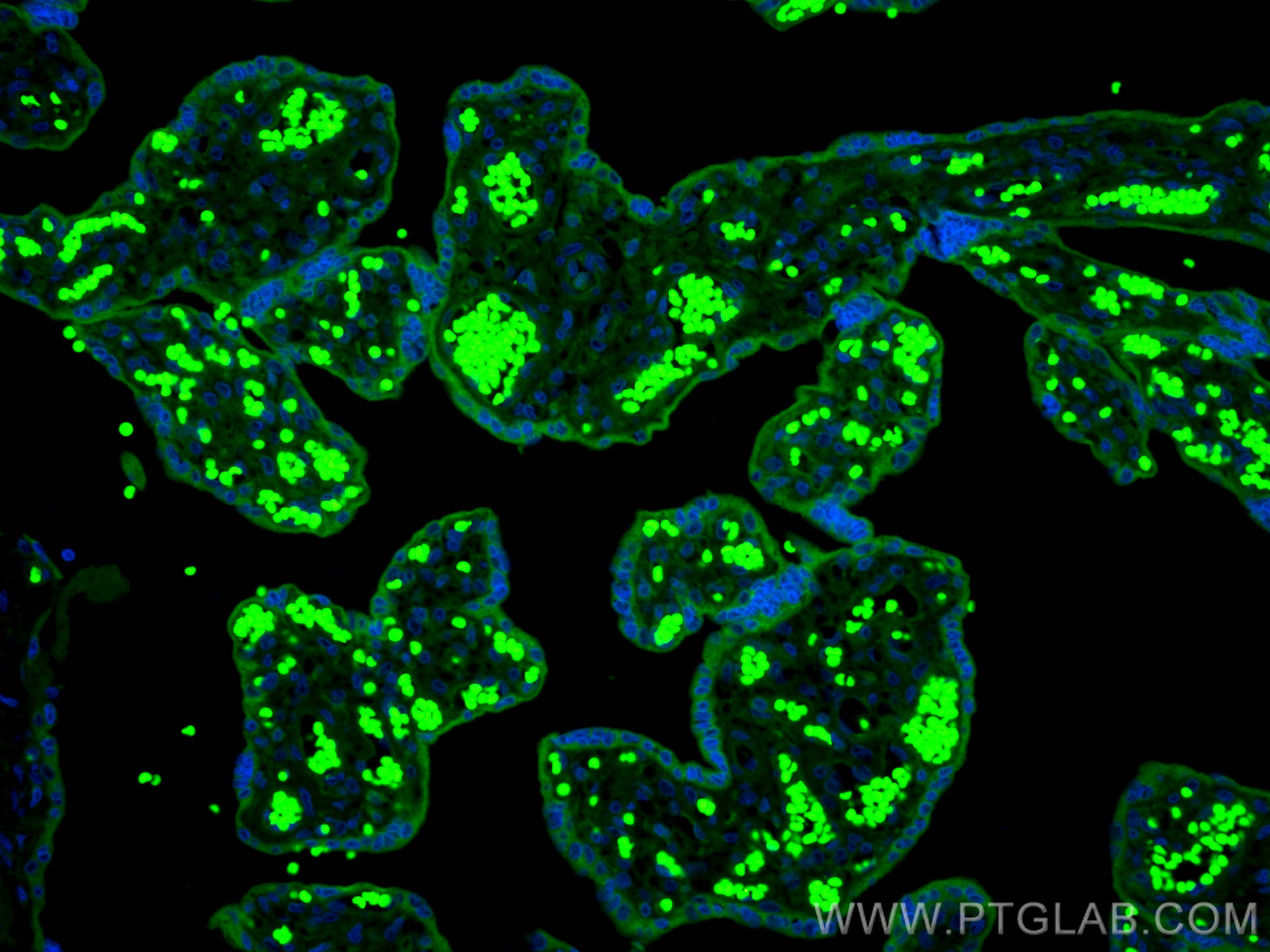 Immunofluorescence (IF) / fluorescent staining of human placenta tissue using CoraLite® Plus 488-conjugated TRPC6 Polyclonal ant (CL488-18236)