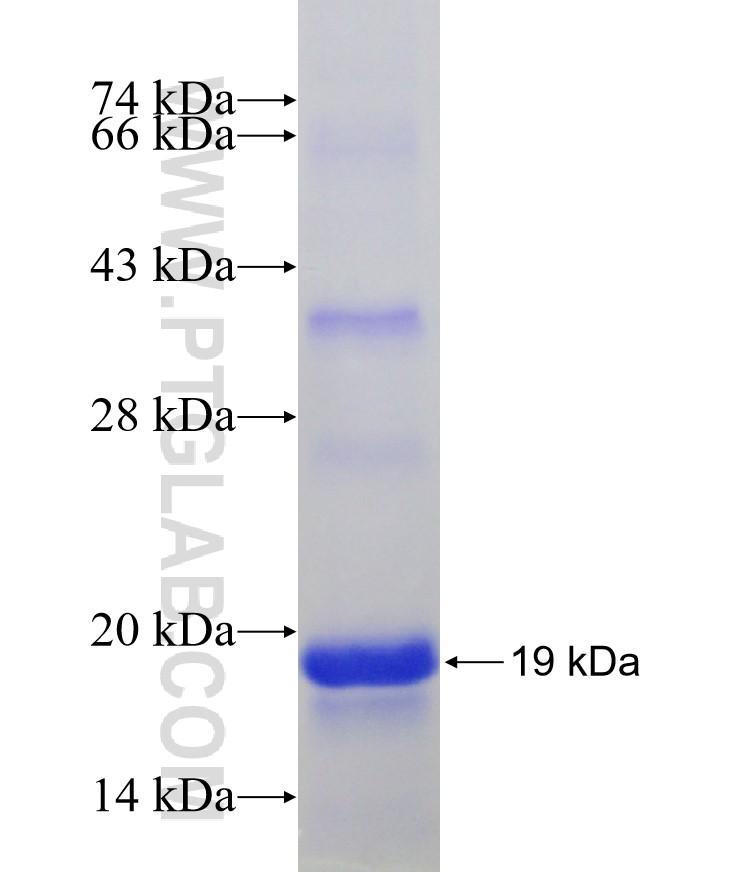 TRPM8 fusion protein Ag31012 SDS-PAGE